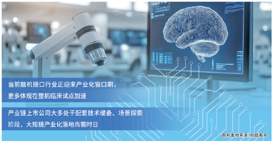 脑机接口迎产业化窗口期